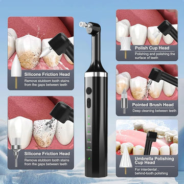 Hangsun PP200 Electric Tooth Polisher & Stain Remover